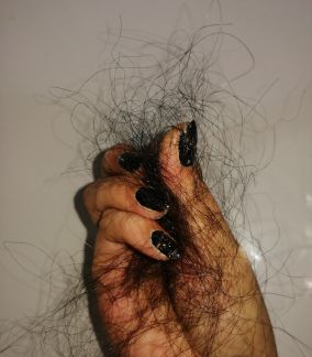 how to stop hair fall